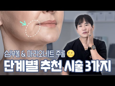 심부볼, 마리오네트 주름 비수술로 깔끔하게 정리하는 3가지 시술 추천