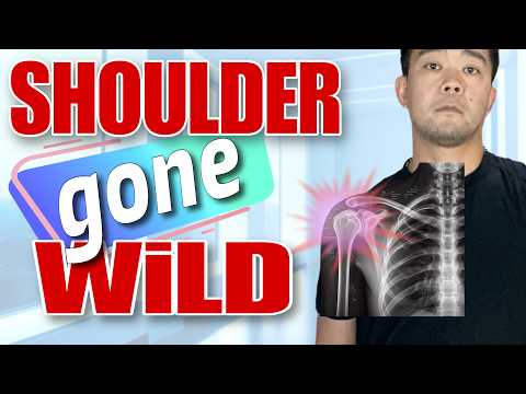 Shoulder Gone Bad? Quick Subluxation and Disclocation Therapy Exercises