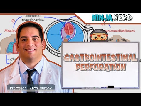 Gastrointestinal Perforation | Clinical Medicine