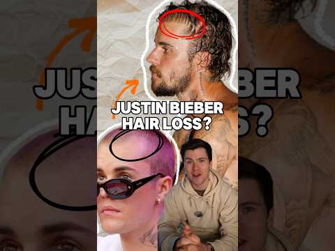 Justin Bieber’s hair transplant?! 🤔