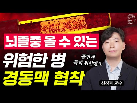 뇌로 가는 길이 막혔다! 경동맥 협착, 수술 vs 시술 선택 기준 완벽 정리 | 신경과 전문의 총정리