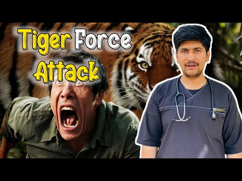 How to Survive a Tiger Attack ?