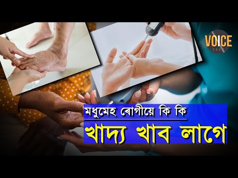 মধুমেহ ৰোগীয়ে কি কি খাদ্য খাব লাগে