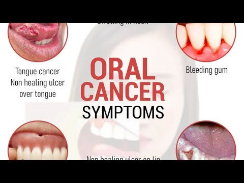 Oral Cancer Symptoms  #oral  #cancer #viral #shorts #1million