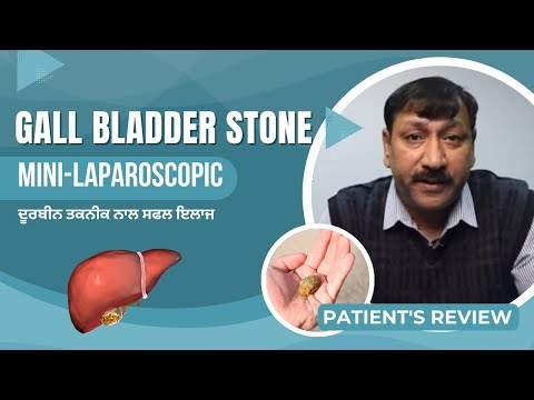 Best Hospital for Gall Bladder Stone in Mohali | Best Gall Bladder Doctor | Gall Bladder Treatment