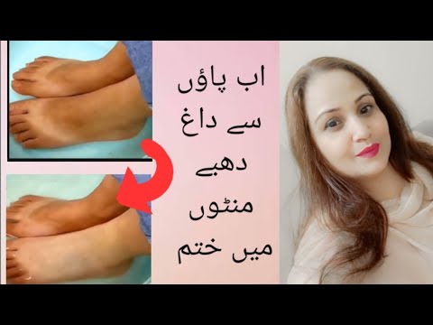 How to remove skin tan easy remedy 🤩🤩 #ytshort #skincare #trendingshort  #saminawaheedbestshort