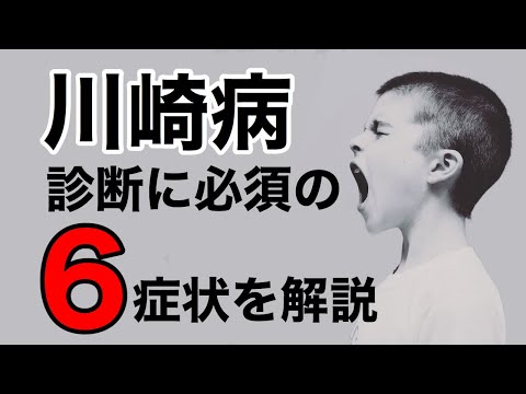 【解説】川崎病の診断に必要な6症状を小児科医が解説します。