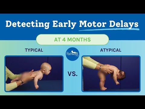 4 Month Typical & Atypical Motor Development | Baby Motor Development Exam