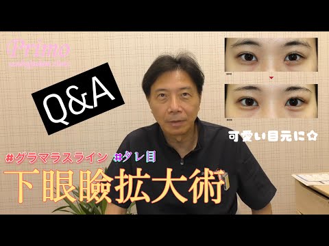 下眼瞼拡大術・質問動画★☆美容外科・美容整形☆★