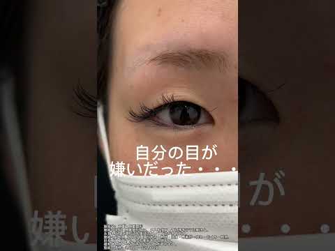 二重埋没なら湘南美容クリニック豊田院💖