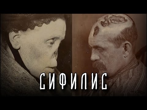 СИФИЛИС | История Самой Позорной Болезни