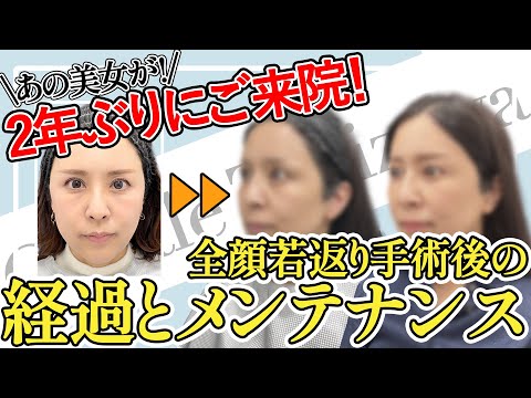 2年後どうなった⁉️50代の全顔若返り美魔女が2年ぶりのご来院☆貴重な長期経過をご紹介！