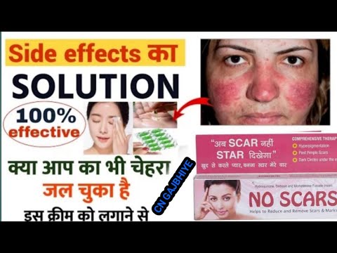 No scars Cream | no scars cream ke sideeffects kaise thik kare | no scars cream cream side effect