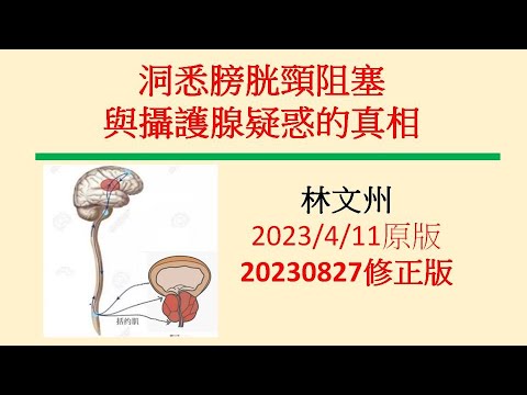 洞悉膀胱頸阻塞與攝護腺疑惑的真相－林文州20230827修正版