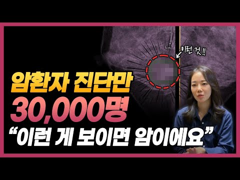 암 진단만 30000명 하면서 느낀 것들