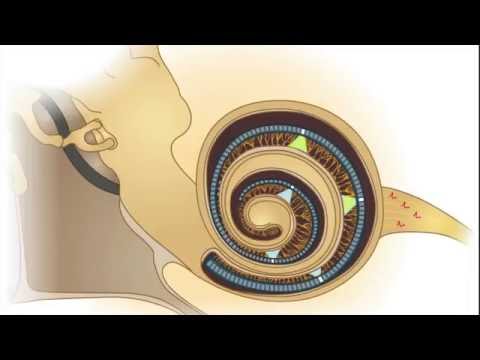 Hören mit Licht - optische Cochlea-Implantate