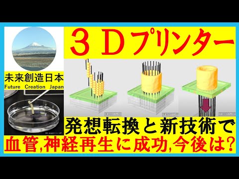 【再生医療の未来】メディカル3Dプリンターで臓器移植も可能に！？ #再生医療 #3dプリンター #メディカル #成長因子 #ニュース