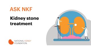 Kidney stone treatment | National Kidney Foundation