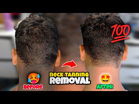 Neck Tanning Remove Ke Liye Kya Kare 😱 | Neck Tanning Treatment | Neck, Face, Body, Tanning Removal