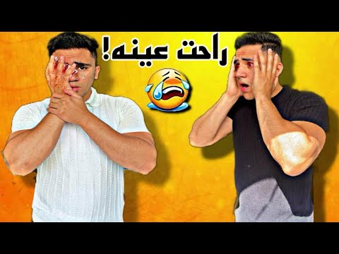 اقوي مقلب في محمد عيني راحت - التوينز