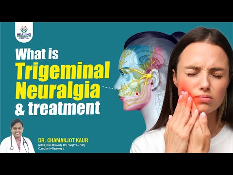 5 Trigeminal Neuralgia Pain Attack TRIGGERS You Need to Know