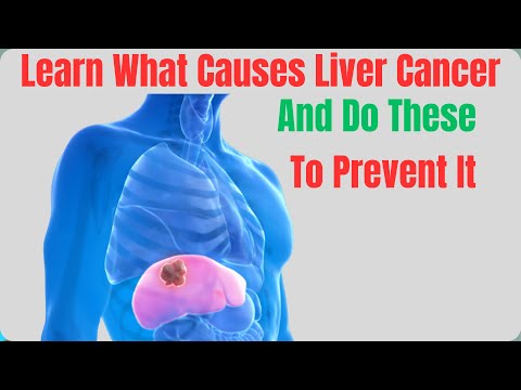 5 Causes Of Liver Cancer | And How to Prevent Liver Cancer