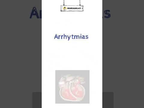 Signs of Hypocalcemia | Neuroaholics #shorts #shortvideo