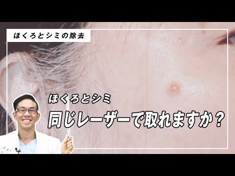 【レーザー治療】ほくろとシミは同じレーザーで取れますか？