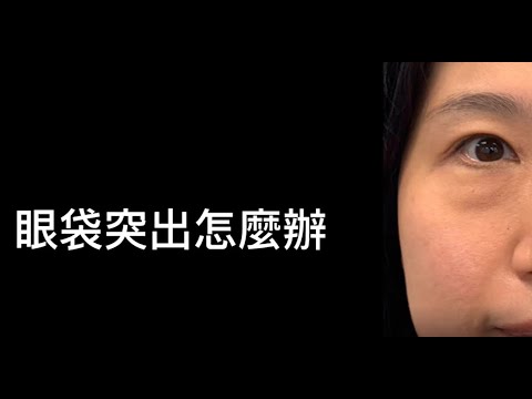 佳醫美人 新式無痕眼袋手術 自體補脂  李兆翔院長