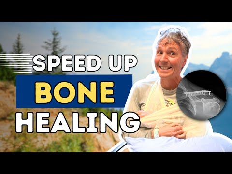 Recovering from a Broken Collarbone: Top 5 Remedies for Rapid Bone Recovery