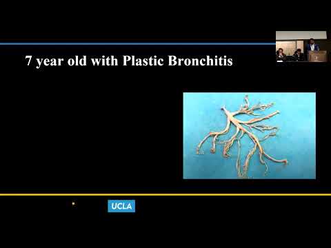 Lymphatic Intervention for the Failing Fontan - Sanjay Sinha, MD