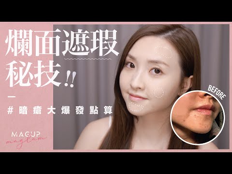 【MAG UP💓】爛面遮瑕大法💓｜遮瑕｜暗瘡皮膚｜化妝｜林欣彤 Mag Lam