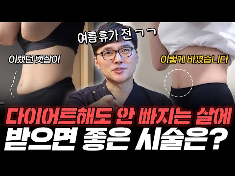 다이어트를 보완해 주거나 다이어트를 실패했을 때 받으면 좋은 시술은? ｜ 스테로이드는 정말 위험하기만 할까?