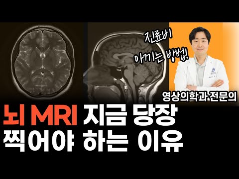 단순 두통, 어지럼증으로 MRI 찍으면 진료비 폭탄 맞습니다!  l MRI 보험 적용 기준 강화 [닥터인사이드]