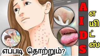 AIDS symptoms in Tamil/AIDS in Tamil/hiv explained in tamil/aids explained tamil/hiv symptoms tamil