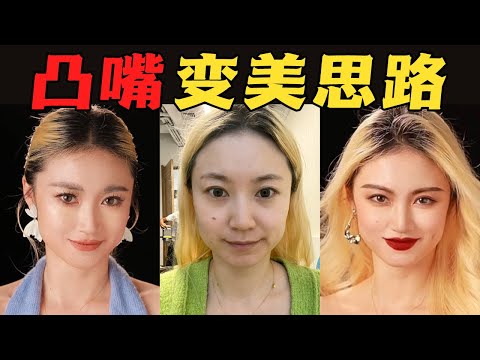 真假凸自测｜别让假“凸”嘴害你受整牙之苦  假性微凸女孩的2个美女思路