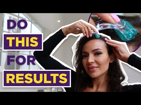 Dermaroller for Hair Loss: How to get results and MAJOR hair growth