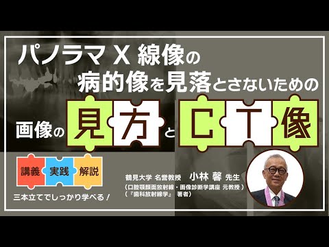 【講演紹介】パノラマX線像の病的像を見落とさないための画像の見方とCT像