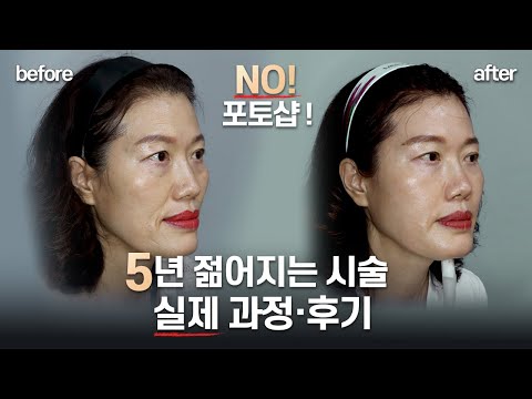 (전후사진 포함) 50~60대 5년 젊어지는 법 ❗❗ 이렇게 쉽게??