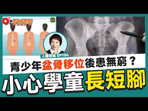 小心學童長短腳，盆骨移位後患無窮？！ 分享體驗香港徒手治療！《#人體解碼︱第106集》CC字幕︱徒手治療︱徒手整形︱物理治療︱養生︱中醫︱健康︱FMTV