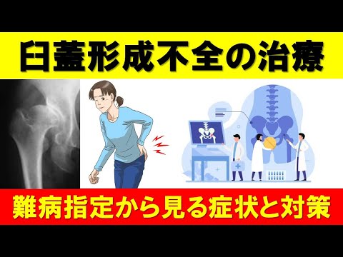 臼蓋形成不全の治療：難病指定から見る症状と対策