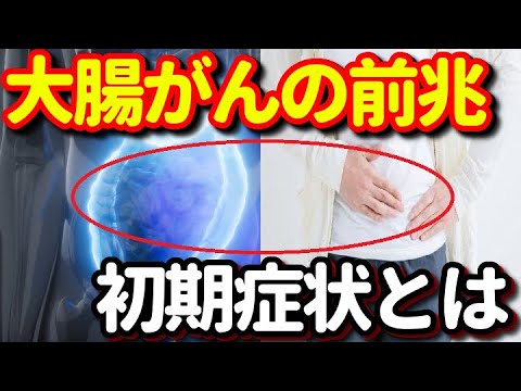 大腸がんの前兆８選！大腸に腫瘍があると便がどう変化する？身近な症状が実はあれだった？知ってよかった健康雑学