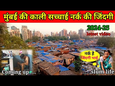 नर्क से भी बत्तर जिंदगी मुंबई || Mumbai Biggest slum areas Dharavi || kandiwali slum life in mumbai