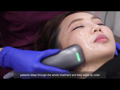 Sygmalift Instant V Shape Face Lift HIFU