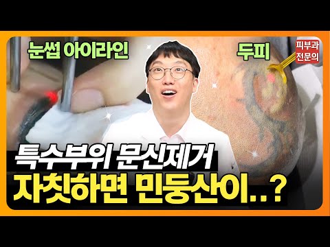 👀특수부위 문신제거? 피부과 전문의가 알려드립니다!✨ | 눈썹, 두피, 아이라인