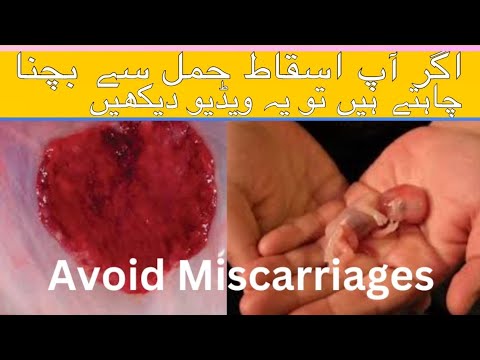 Prevent miscarriages in early pregnancy: Expert advice in Urdu | Hindi hamal zaya hony se roken