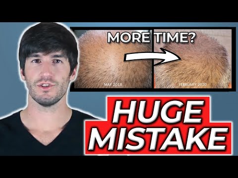 "Maybe I Need More Time For Regrowth" - HUGE Mistake!