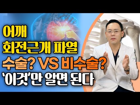 어깨 회전근개파열, '이럴 땐' 수술 필요 없습니다! - 제애정형외과 서희수 원장 4편 #어깨통증 #어깨수술 #어깨재활