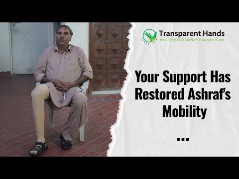 Transparent Hands Restores Mobility for Diabetic Patient Ashraf.