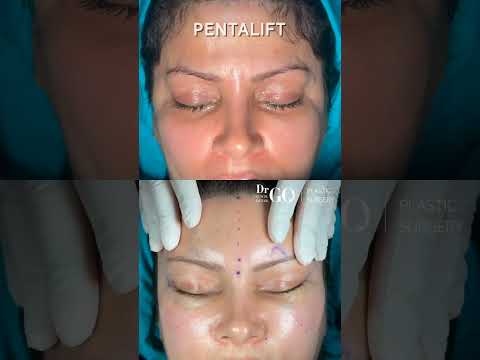 Pentalift Transformation Journey 🌟